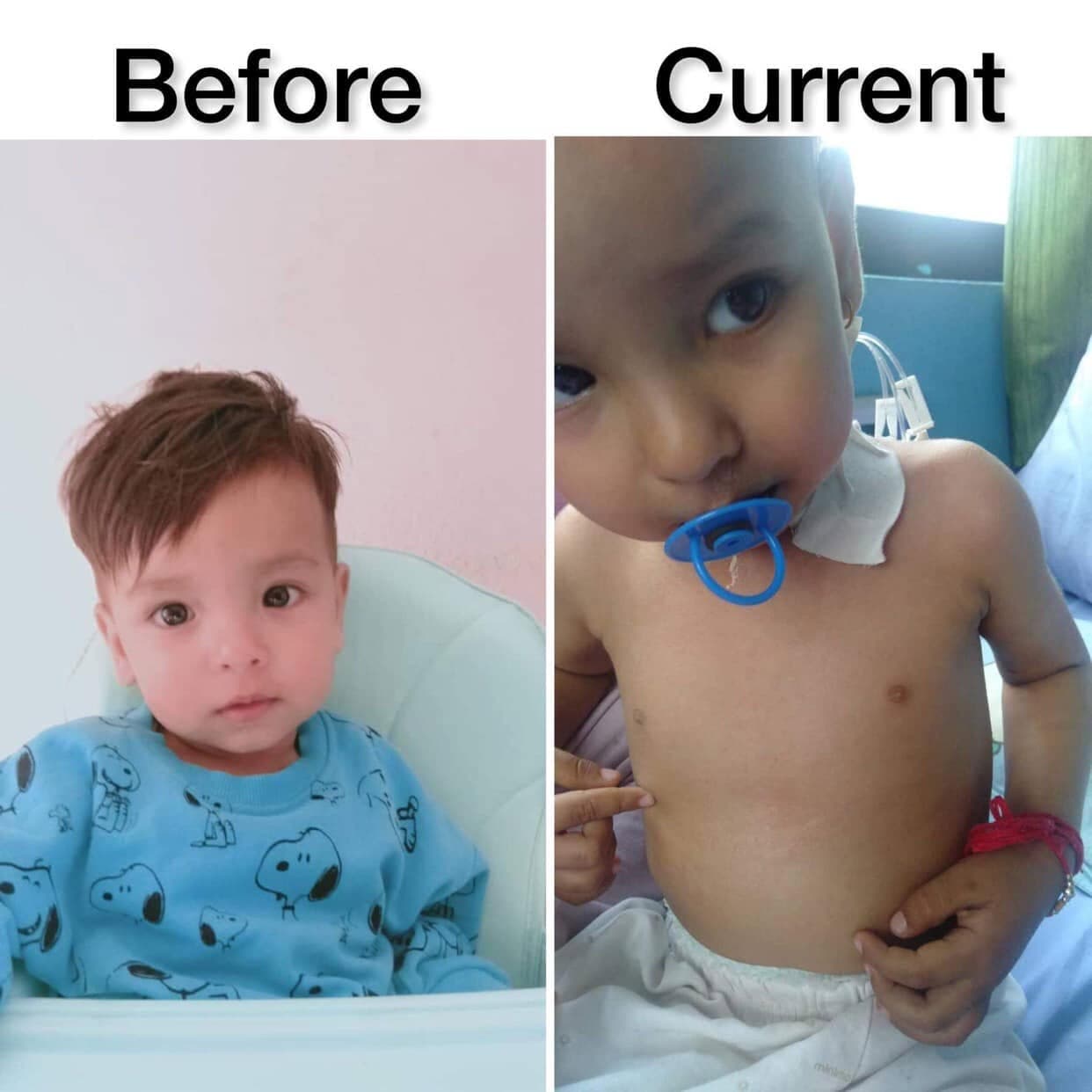 Baby Advik KC smiling in hospital